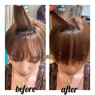 顔まわり縮毛矯正