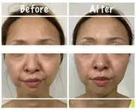 魔法のエイジングケアフェイシャル❤️たるみ・くすみ・むくみ・小顔・高保湿【当店フェイシャル人気No1】