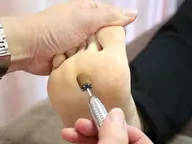 【ドイツ式フットケア】　魚の目、タコ除去、角質ケア付き 50分　￥9,000→￥5.400