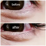 下まつ毛パーマ