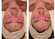 1回で効果実感☆小顔・透明感・無料ﾌｪｲｼｬﾙモニター💆🏻‍♀️✨口ｺﾐ書いてくださる方限定🙇‍♀️