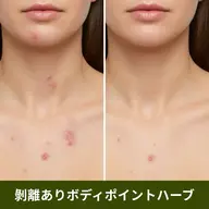 【ポイント施術】ボディハーブピーリング(剥離あり)ヒト幹細胞培養上清液入りハーブ🌿お尻/背中上or下/デコルテ/足/腕