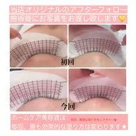 〈ラッシュアディクト（まつ毛ケア）〉¥4378ーインスタ&雑誌各社に紹介多数掲載💛最高級育毛サロン専門ケア(1回)