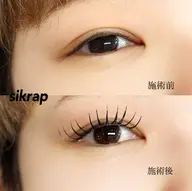 【4/22.23限定🍭】オフ込みフラット120本まで