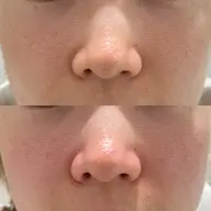 人気No.1⭐️ 「至近距離でも怖くない！夏の太陽に映える、つるんとした『水光肌』を今すぐ仕込みませんか？✨」約30分