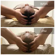 【ミニモ限定価格】脳疲労/小顔/肩コリ【小顔ドライヘッドスパ＋デコルテ70分】¥14,000→¥8,800