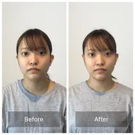 『施術後アンケート特別価格』ミニモ限定小顔ケアと骨盤ケア＋お悩み別OP50分¥15900-＜小顔解消/小顔姿勢＞