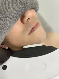 【2回目以降】お髭脱毛(30分)