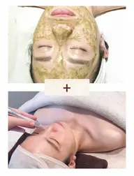 【ハーブピーリング+毛穴吸引】毛穴レス美肌✨(毛穴/ニキビ/ザラつき/シミ/シワ)