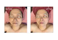 光フェイシャル✨✨ たるみ、シミくすみが気になる方へ。首、肩、デコルテマッサージ付