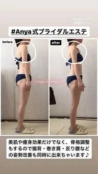 人気のブライダルエステお試し☆二の腕背中デコルテ｛ハイパーナイフ＆ハイパーウェーブ｝60分