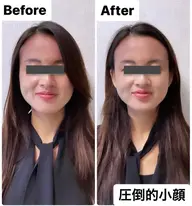 ★人気No.1★【整形級の小顔矯正】＋【脳爽快!頭皮はがし】で更に小顔効果◎小顔をより実感したい方は絶対こちら！