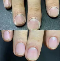 ベーシックケア