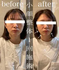 人気メニュー小顔整体