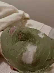 ニキビ肌特化メニュー🤍ピーリング付き🫧繰り返すニキビにお悩みの方はこちら🫶脂性肌/毛穴/アクネ菌滅!!🤞