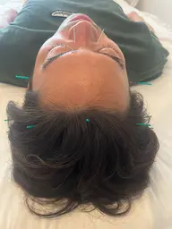 頭痛・眼精疲労ケア