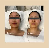 【3月限定メニュー❕】小顔効果&トーンアップあり‼︎フェイシャルマッサージ💆🏻♀️🌟+お肌診断付き