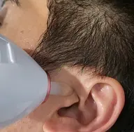 【福岡希少メニュー】自分では見えないからこそ身だしなみは大事！耳毛脱毛　20分　￥3,850→￥1,100回数：1回