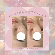 GW限定❣️ぷるもち肌フェイシャル【毛穴×小顔×ツヤ】毛穴の広がりが気になる方へ✨1980円