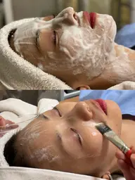 【ミニモ限定★贅沢3step】毛穴洗浄×ララピール×エレクトロポレーション🫧