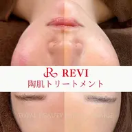 初回お試し♪【剥けないハーブピーリング】がさつき・肌荒れ・美白・毛穴改善