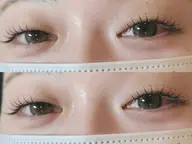 【＆healthy120本💫¥9800】最新技術まつ毛パーマ✖️エクステ🐩