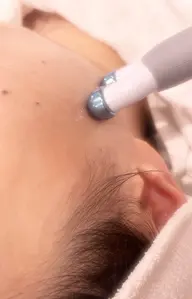 電気の力で効果実感、ポレーションエステ