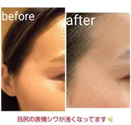 🎀ミニモ限定🎀小顔マッサージでぷるぷるハリ肌へ ♡AI搭載肌診断付