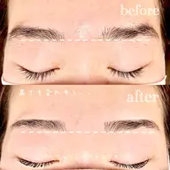 アイブロウワックス脱毛