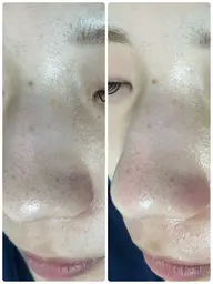 《全顔フェイシャルWAX＋鎮静保湿ケア》