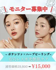 【ポテンツァ マイクロニードル使用】ニキビ ニキビ跡 毛穴に効果的❣️ エクソソーム導入×ハーブピーリング同時施術‼️