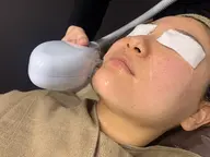 練習モデル☆顔脱毛＋美白パックセット