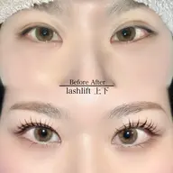 顔面偏差値UP💎ﾗｯｼｭﾘﾌﾄ【上下】