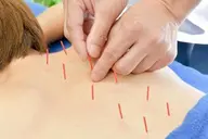 【minimo限定価格🎵】✨整体&鍼施術✨