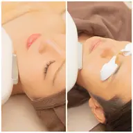 レディース・メンズ■IPL光フェイシャル■美肌/ハリ/シミシワ/毛穴/肌質改善■5500円