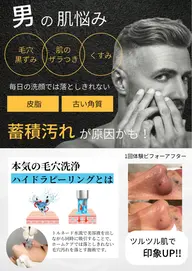 【毛穴洗浄】メンズ限定👦🏻ハイドラフェイシャル(全顔)