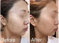 肌結果をお約束フェイシャルエステ《FAITH生コラーゲン5ステップ》