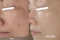 【結果重視◆シミたるみ改善】ダクトピール×高濃度美容液導入×ヘッドスパ