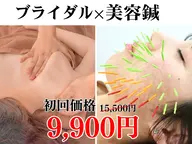 【プレ花嫁人気No.1】ブライダル整体×美容鍼(90分)（リフトアップ/小顔/肩甲骨はがし/姿勢矯正）
