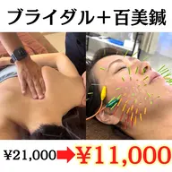 【✨ミニモSALE✨】ブライダル整体×百美鍼(100分)（美容鍼100本/小顔/肩甲骨はがし/姿勢矯正）