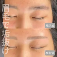 🫧予約殺到🫧美眉アイブロウWax脱毛
