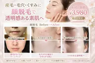 期間限定！顔脱毛