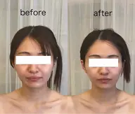 フェイシャル（スタンダード）