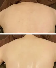 肌荒れの無い美背中に🪞酵素ハーブピーリングで徹底毛穴ケア🤍ツヤのあるきめ細かいお背中に💫