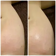 ツヤ玉✨痛くない＆剥離なしで幹細胞エキス配合ハーブピーリング🌿60min