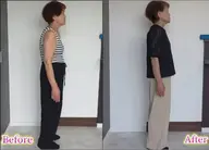 全身プロポーション矯正×整形級小顔矯正