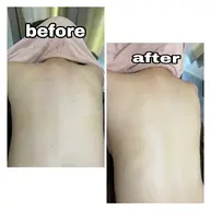 【背中ケア】🩵ྀི 背中ニキビやブライダルに✨