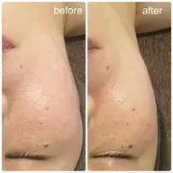 スッキリ小顔🌼お顔のむくみコリとりクイック30min