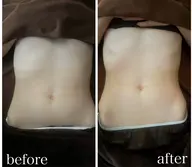 結果出し   【腸もみ 】モニター募集