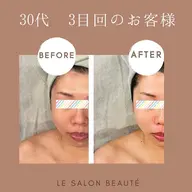 ◆ヒト幹細胞リフトアップ＋小顔マッサージ◆デコルテ→首ケア→ドライヘッド付き！首肩コリ、眼精疲労の方へもおすすめです！